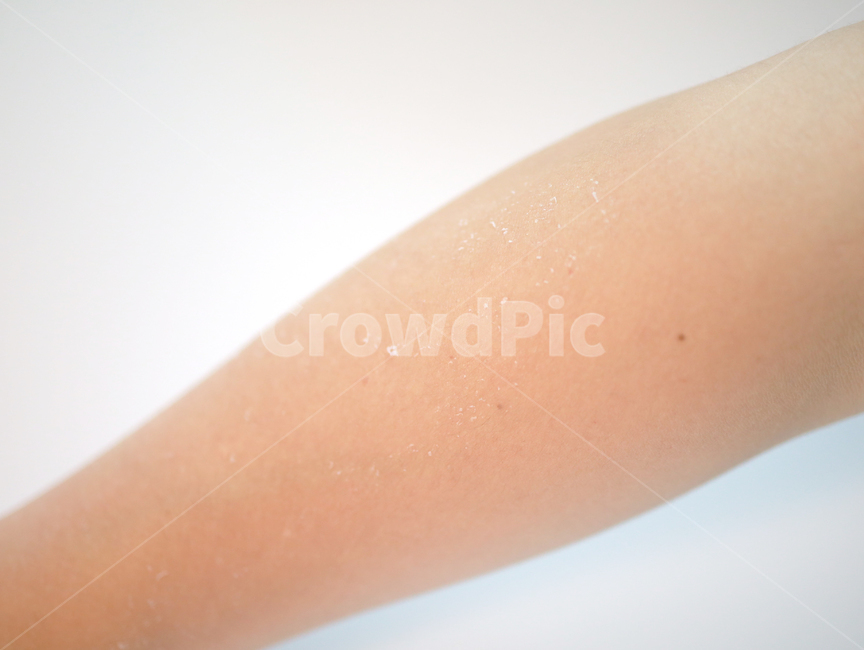 skin,피부,각질,선크림,태닝,피부화상,화상,팔,사람,인물,인간,human,person,신체일부,몸,body
