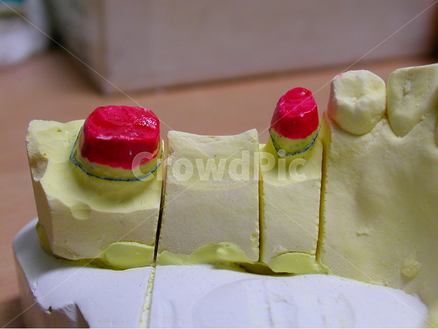 치과,의료,보철,치과기공사,석고,크라운,기공사,dental,모형,브릿지,의료,의학,병원,medical,hospital,clinic,사물,물건,오브젝트,thing,object,matter