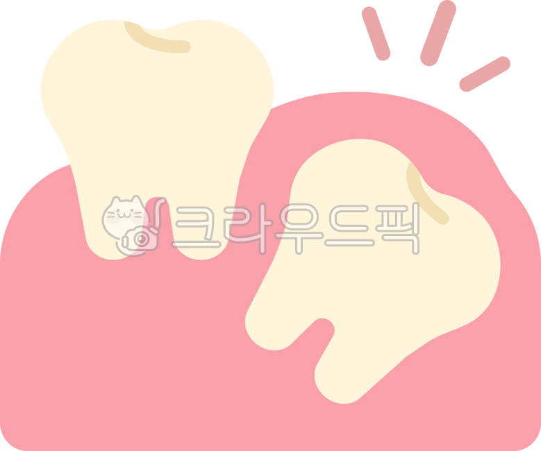 Impacted wisdom tooth,wisdom tooth,wisdom tooth extraction,wisdom tooth extraction,wisdom tooth pain,extraction,wisdom tooth rash,back molar,molar,wisdom tooth removal,dentistry,teeth,teeth,this,wisdomtooth,dental,dentist,tooth,teeth,gu