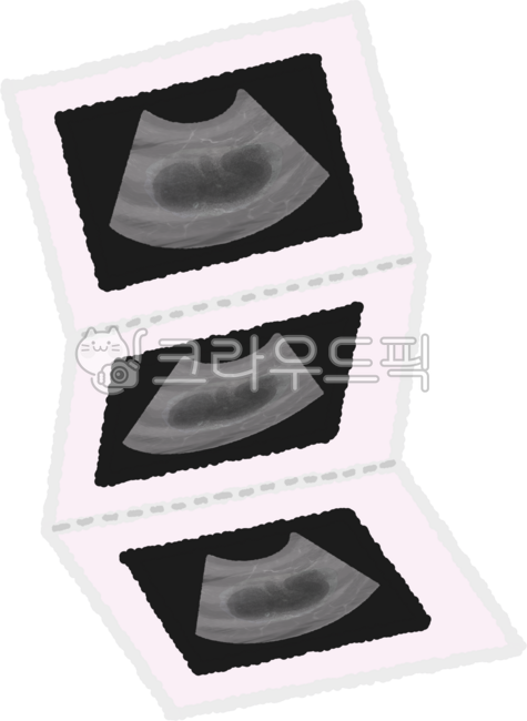 pregnancy,pregnancy,pregnant woman,pregnant woman,ultrasound,fetus,fetus,baby in womb,baby in the womb,pregnancy test,pregnancy test kit,mother and baby,new life,warm moment,miracle of life