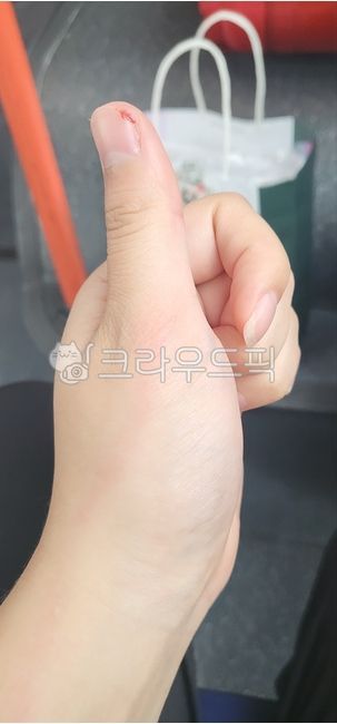 hand,손,사람,손가락,finger,상처