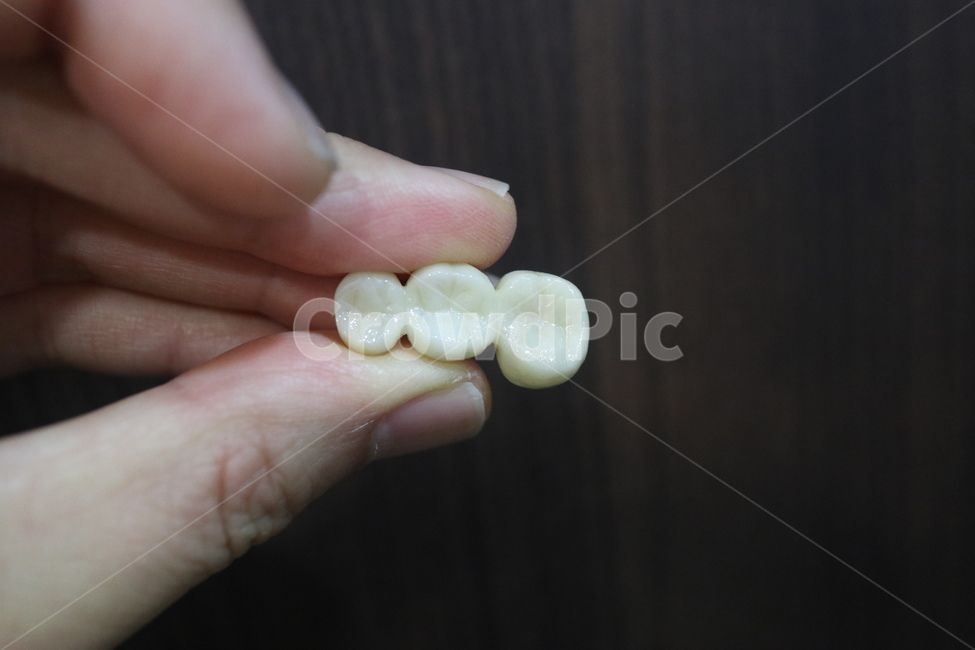 치과,보철,지르코니아,덴탈,dental,zirconia,의료,의학,병원,medical,hospital,clinic