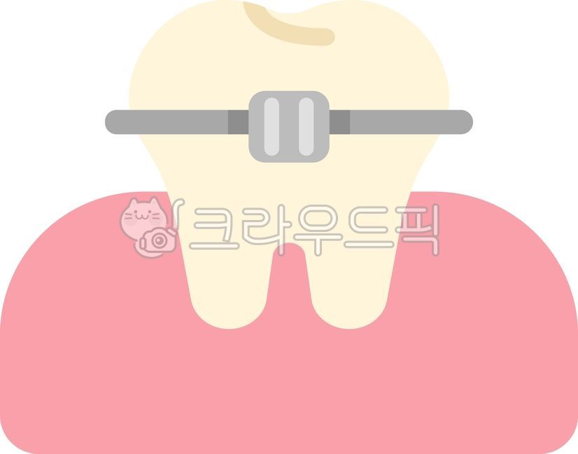 Correction,orthodontics,teeth,teeth,orthodontics,dentistry,dental orthodontics,orthodontic dentistry,orthodontic teeth,orthodontics illustration,orthodontics illustration,teeth illustration,this,hospital,dental treatment,dental treatment,d