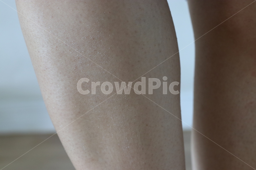 다리,무릎,종아리,신체,사람,닭살,각질,skin,피부,사람,인물,인간,human,person,신체일부,몸,body