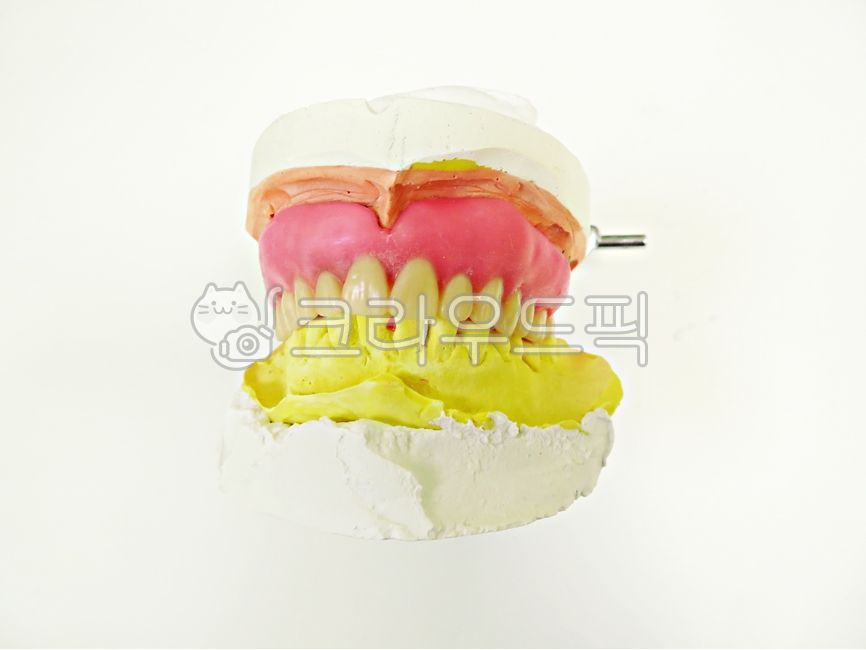 틀니,치과,의료보험,구강,의료,보건,의학,구강보건,치의학,치과의사,의치,전체틀니,총의치,치아,레진,왁스,상악,교합,보험수가,보험틀니,핑크,노랑,치과기공,보철,치료,진료,환자,노인,oristhetic,dental,denture,dentist,hospital,medical