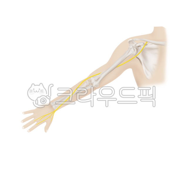 질환,메디컬,일러스트,설명,요골신경,해부학,정상,의료,의학,병원,medical,hospital,clinic