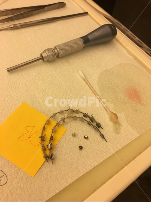 교정,클리피씨,교정장치,치과,교정치과,치과풍경,의료,의학,병원,medical,hospital,clinic