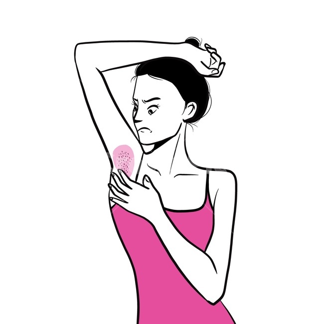 겨드랑이,냄새,불쾌감,겨드랑이털,암내,왁싱,제모,콤플렉스,여성,여자,girl,woman,여성청결,뷰티,미용,beauty treatment,그래픽,일러스트레이션,graphic,illustration