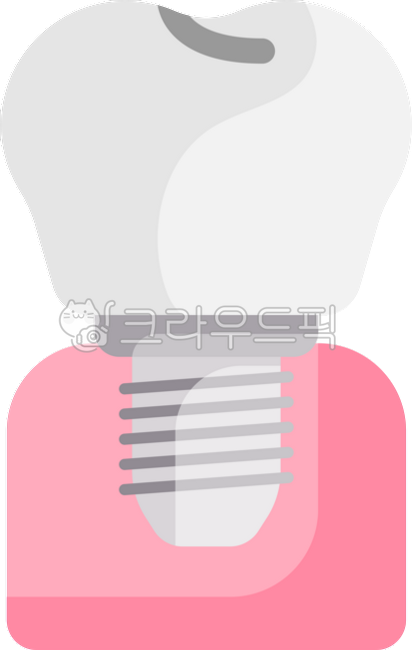 Implant,dentistry,prosthesis,prosthesis,dental,artificial teeth,implant icon,implant illustration,implant clip art,implant logo,implant silhouette,tooth,teeth,oral cavity,screw,gums,plant,implant placement,implant,dental implant,teeth,