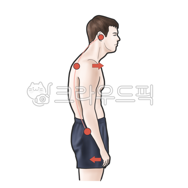 라운드숄더,굽은어깨,증상,질환,의료,의학,의료,의학,병원,medical,hospital,clinic