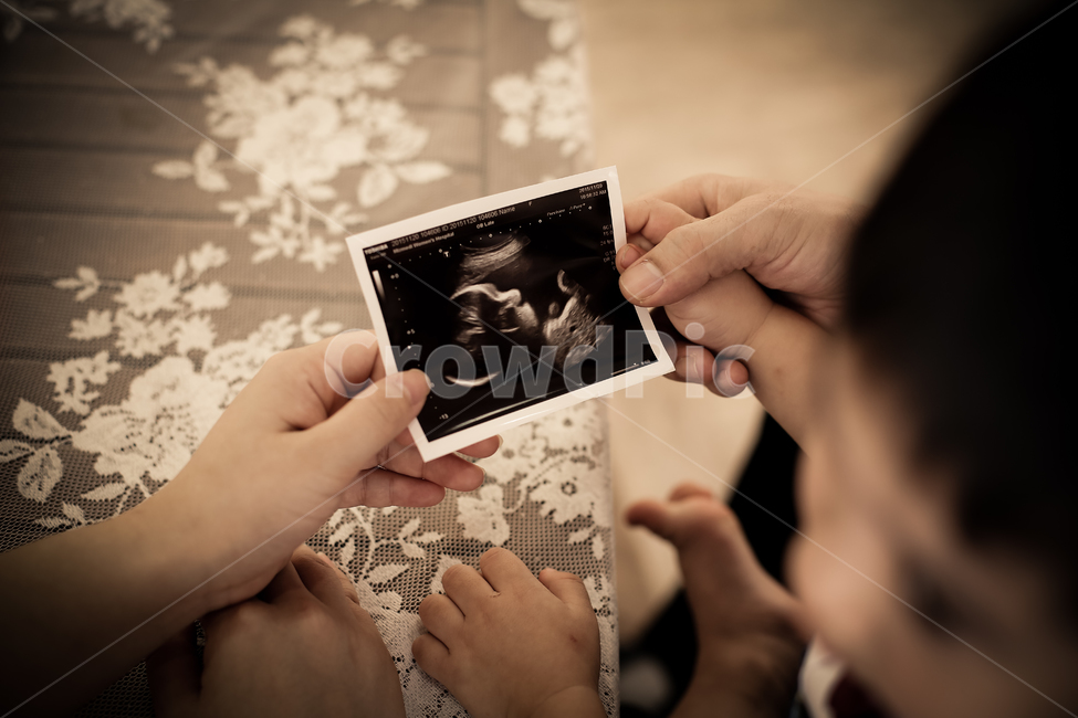 사람,human,person,손가락,finger,초음파사진,사람,인물,인간,human,person,영유아,아기,애기,아이,infants,baby