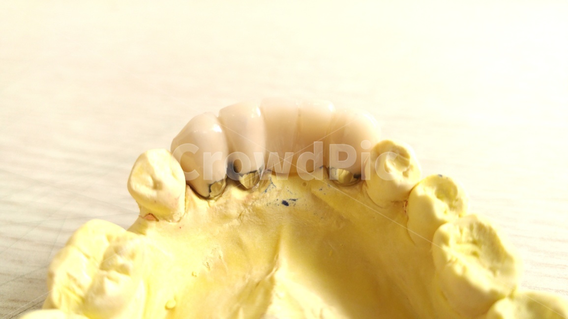 치과,의료,보철,이빨,치아,치과기공사,tooth,포세라인,의료,의학,병원,medical,hospital,clinic,사물,물건,오브젝트,thing,object,matter