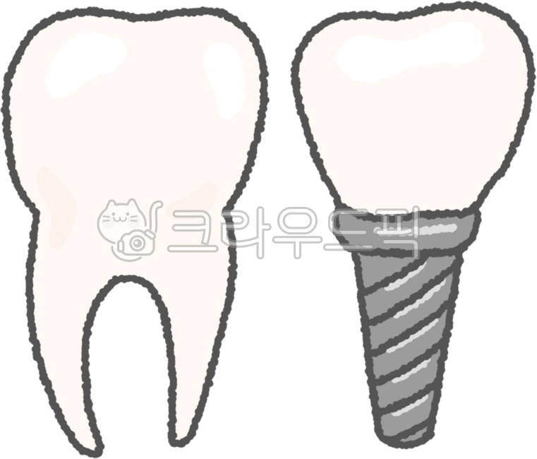 치아,이빨,치과,치과진료,치아보험,치과보험,치아관리,치과의사,치과치료,치주염,치주질환,치은염,치통,이시림,임플란트,치아빠짐,이빠짐,치아손실,치아상실