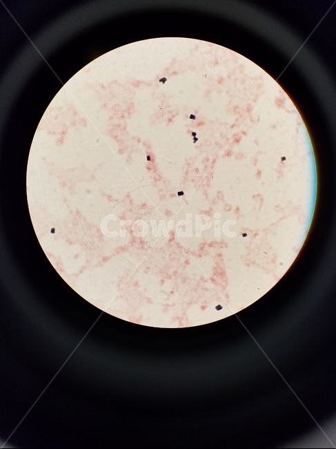 박테리아,streptococcus,cocci,gramstainpositivecocci,미생물