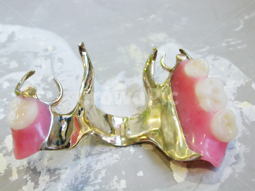 치과,의료,보험,틀니,gold,치과기공사,골드,덴쳐,덴탈,dental,보철,금틀니,의료,의학,병원,medical,hospital,clinic,사물,물건,오브젝트,thing,object,matter