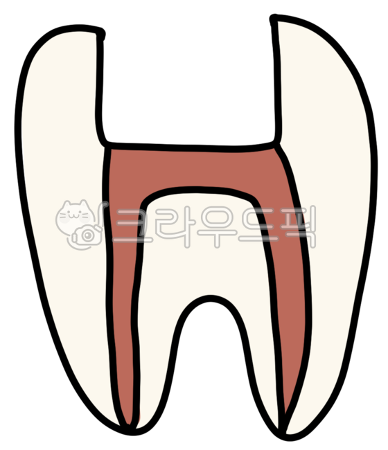 치아,신경치료,엔도,치과치료,신경