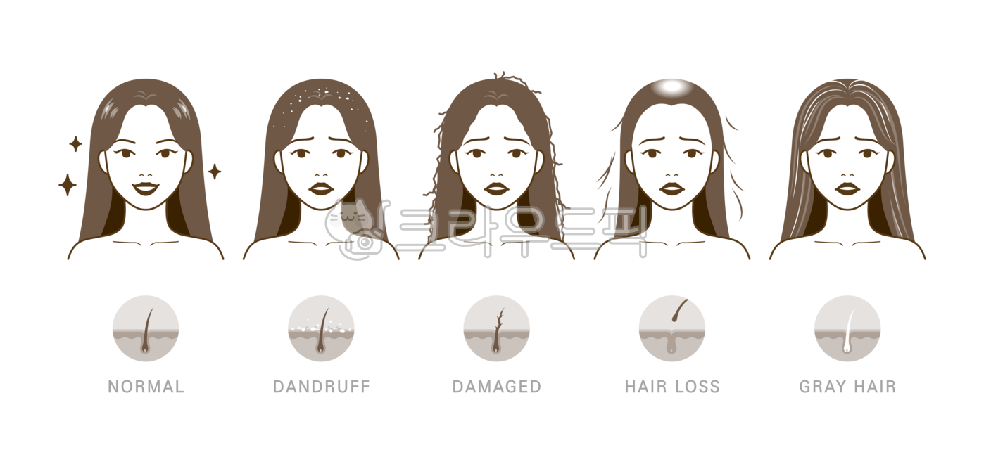 머리,머리카락,모발,머릿결,빠짐,탈모,원형탈모,머리빠짐,풍성한,뺵빽한,머리숱,숱,흰머리,새치,노화,볼륨,문제,손상된,손상모,갈라짐,갈라진,푸석푸석한,푸석한,부스스한,비듬,각질,여자,여성,사람,인물,모델,얼굴,캐릭터,미용,관리,일러스트,비교,세트,예쁜