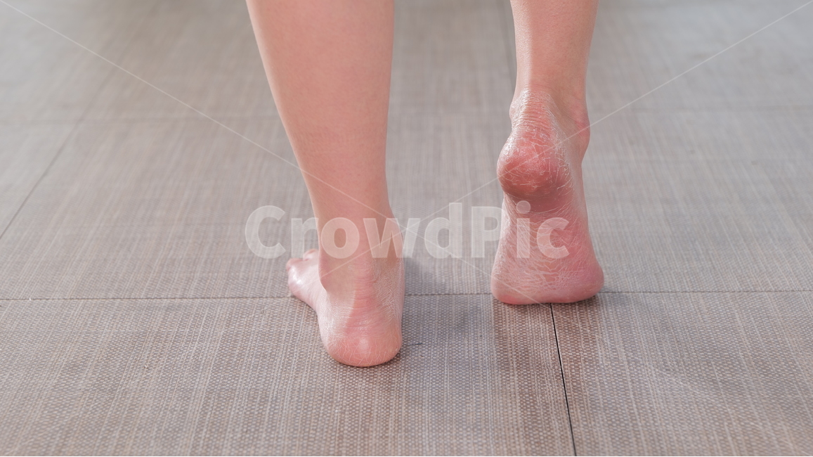 각질,피부,피부트러블,의료,목욕,heel,힐,human,인간,person,사람,발뒤꿈치,body,몸,미용,뷰티,신체,사람,인물,인간,human,person,신체일부,몸,body