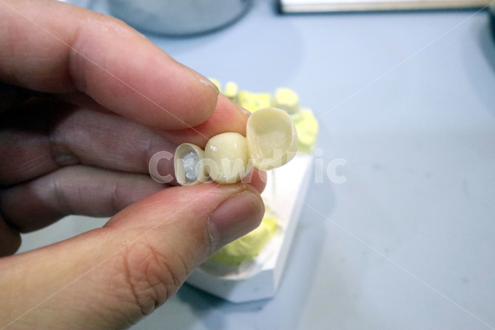 치과,보철,지르코니아,zirconia,이빨,덴탈,치아,의료,보험,의료,의학,병원,medical,hospital,clinic