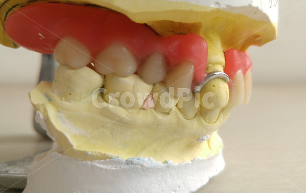 치과,의료,틀니,노인,덴쳐,기공사,보철,의치,교합,denture,의료,의학,병원,medical,hospital,clinic,산업,industry,industrial