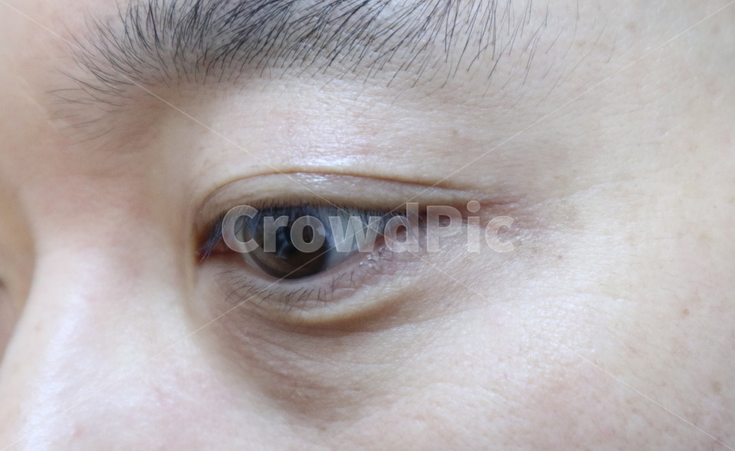 눈,눈동자,눈주변,기미,피부,피부과,쌍거풀,쌍꺼풀,eye,노화,주름,신체,안과,동공,사람눈,속눈썹,사람,인물,인간,human,person,신체일부,몸,body