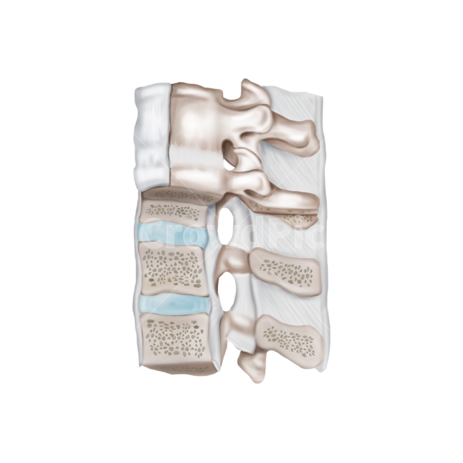 메디컬,medical,png,일러스트,메디컬일러스트,해부학,anatomy,bone,척추,디스크,추간판,단면,누끼,remove background