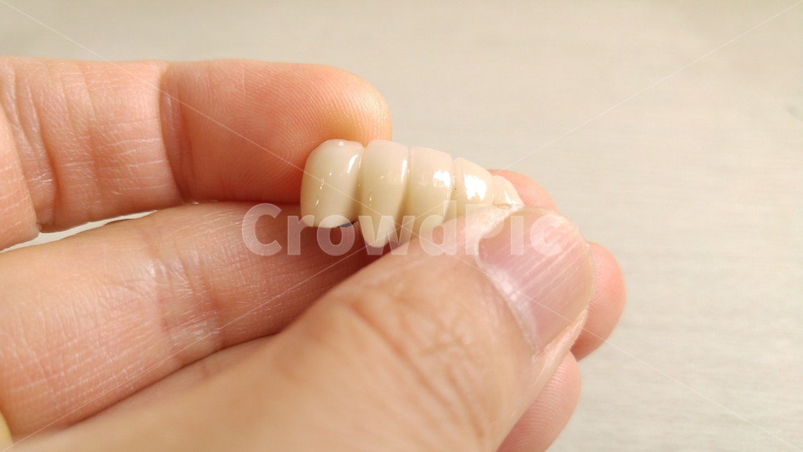 치과,의료,보철,이빨,치아,치과기공사,덴탈,dental,의료,의학,병원,medical,hospital,clinic