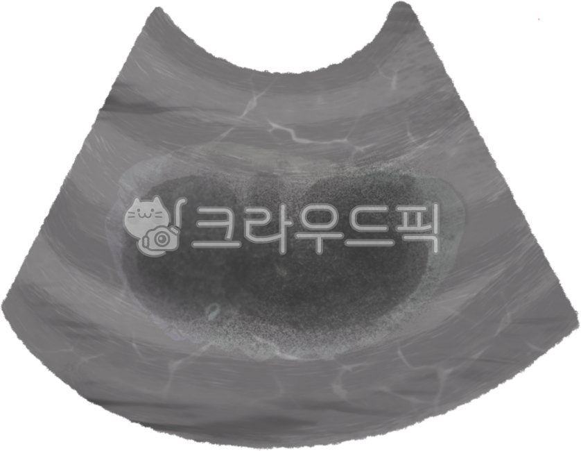 pregnancy,pregnancy,pregnant woman,pregnant woman,ultrasound,fetus,fetus,baby in womb,baby in the womb,pregnancy test,pregnancy test kit,mother and baby,new life,warm moment,miracle of life