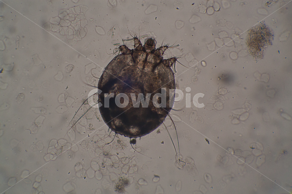 옴,벌레,기생충,옴벌레,scabies,병원,질환,피부질환,피부과,가려움증,동물,진드기,개선증,요양병원,곤충,벌레,insect,bug