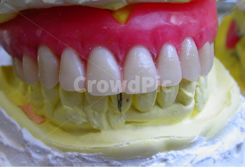 의료,치과,보철,틀니,덴쳐,노인,보험,denture,치과기공사,의치,교합,의료,의학,병원,medical,hospital,clinic