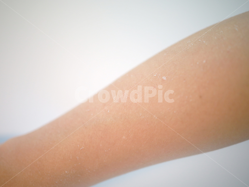 skin,피부,각질,선크림,태닝,피부화상,화상,팔,사람,인물,인간,human,person,신체일부,몸,body