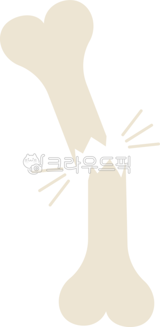 fracture,bone,osteoporosis,orthopedic,broken,cast,joint,severe,trauma,microfracture