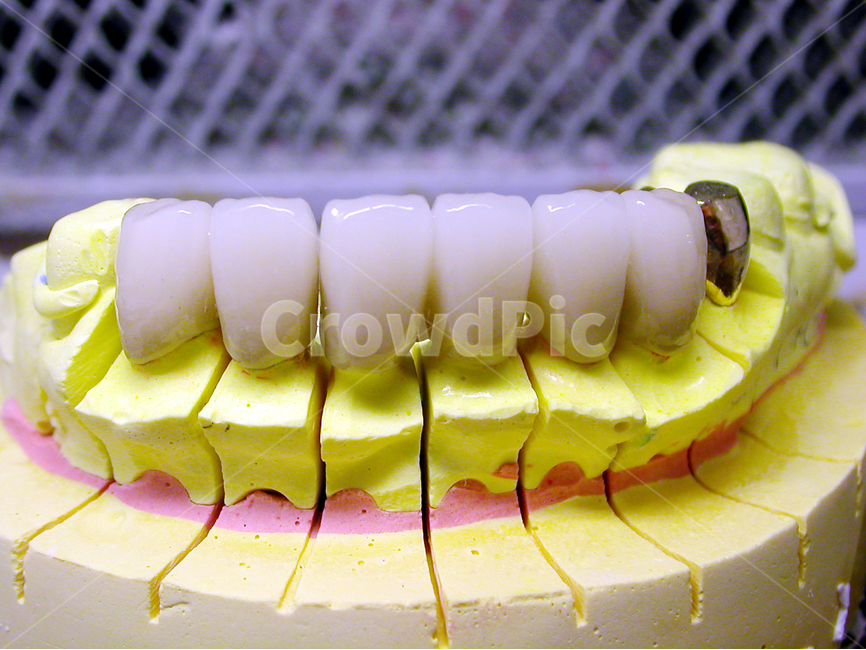 의료,치과,치과기공,성형,도자기,인공치,앞니,dental,하얀이,치료,보철,의료,의학,병원,medical,hospital,clinic,사물,물건,오브젝트,thing,object,matter