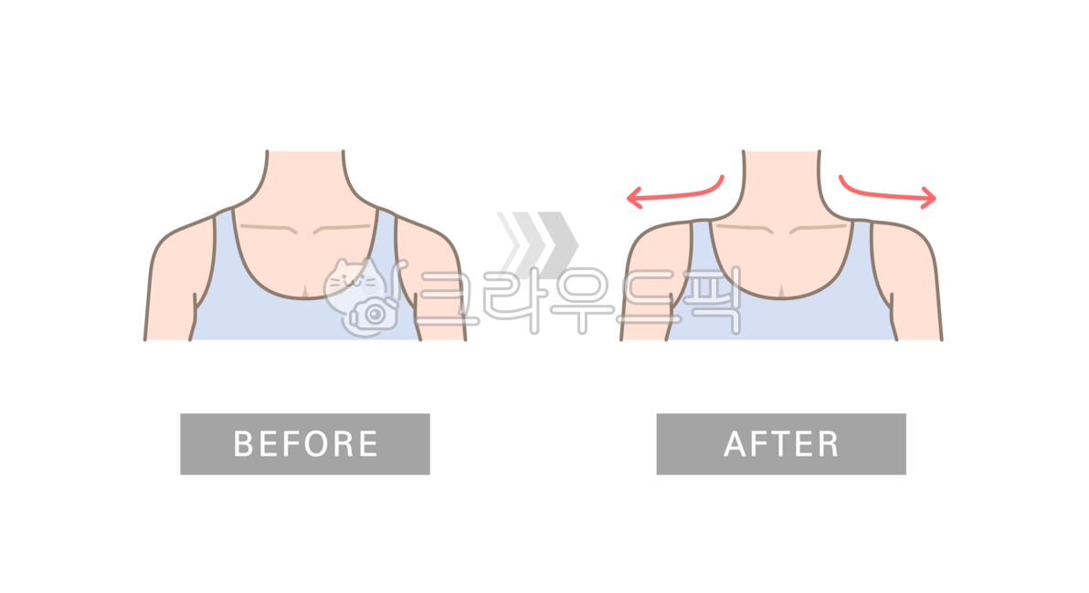 승모근,어깨,올라온,일자,일자어깨,몸,인체,사람,모델,모습,라인,변화,비교,전후,비포에프터,앞,앞면,앞모습,긴장된,뻣뻣한,처진,일러스트,근육,경직