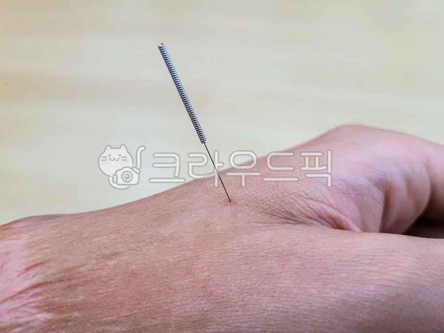 침,한방침,침구학,한의학,한의원,의료,침치료,한방치료,중의학,침술,의학,의료기구,침구,전통,동양,동양의학,바늘,치료,건강,침술요법
