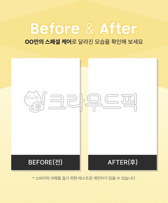 비포애프터,비포에프터,상세페이지,쇼핑몰,배너,제품페이지,상세페이지소스,상세페이지템플릿,디자인,광고,포스터,스마트스토어,템플릿,비교