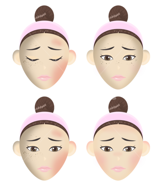 uvb,uva,sunscreen,sun care,charred skin,Detailed page,skincare,skin damage,skin,womans skin,woman face,skin illustration,face,UVrays,UV blocking,illustration,UV exposure,skin irritation